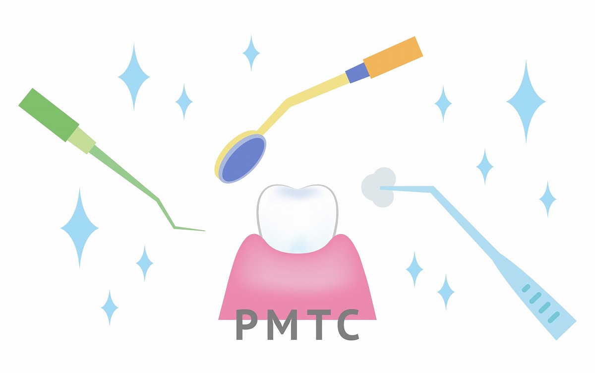 PMTC（プロによる歯のクリーニング）